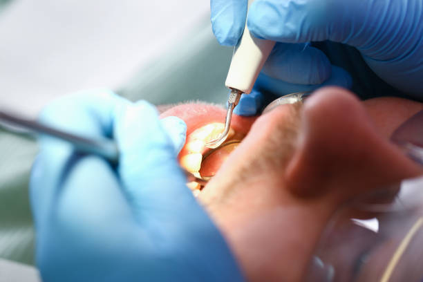 Best Knocked-Out Tooth Emergency  in Whitney, TX