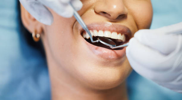 Best Teeth Whitening  in Whitney, TX
